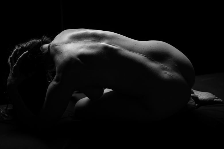 Back Scar Artistic Nude Photo By Photographer GenuineBurke At Model Society