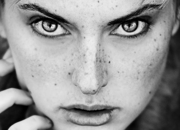 Freckles Close Up Photo by Photographer gracefullywicked