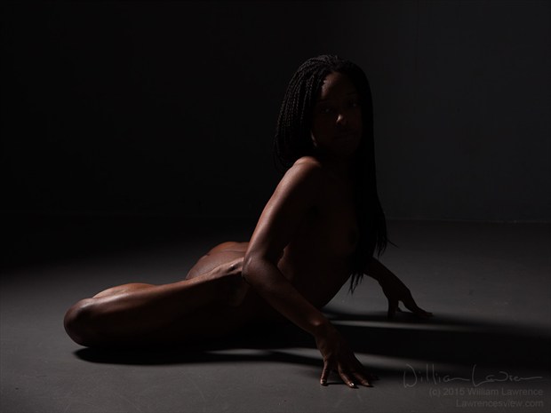 Knee Dislocation Artistic Nude Photo by Model QUINTESSENCE